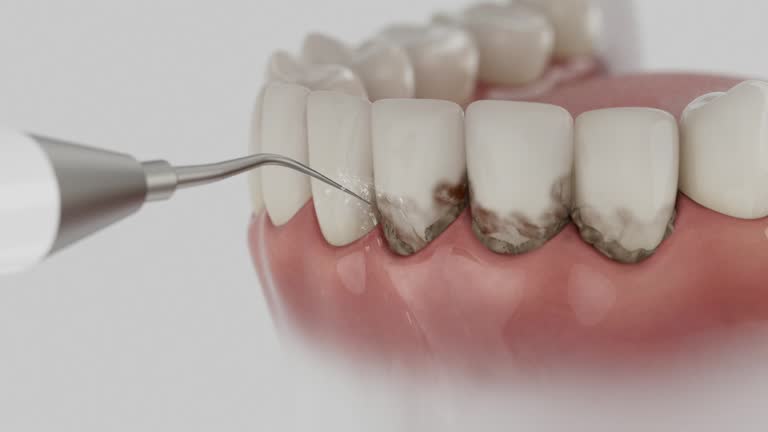 Trusted Dental Implants service in Wood Dale, IL - Dentist Open Now
